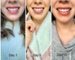 Crest - 3D Whitestrips Professional Transformation – Image 2
